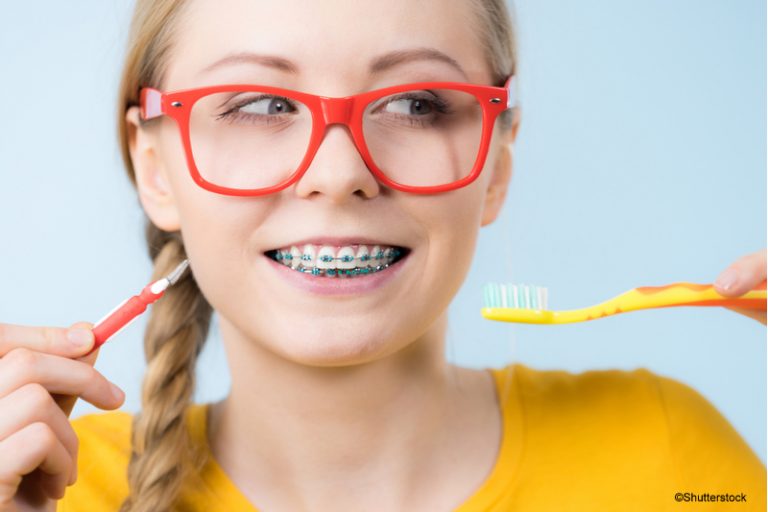 How to Clean Your Teeth With Braces Corsa Orthodontics
