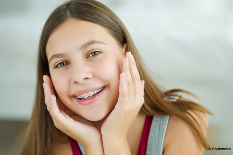 All You Need to Know About Your New Braces | Corsa Orthodontics